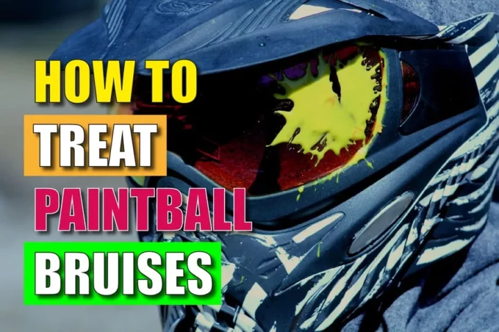 How To Treat Paintball Bruises